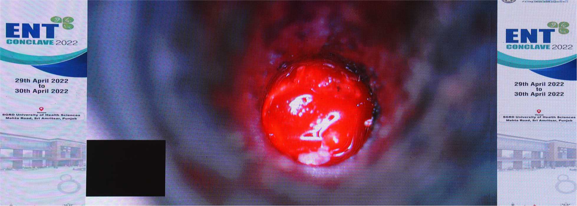 galimgs/ENT CONCLAVE 2022 - International Live Surgical Conference/P - 2.jpg
